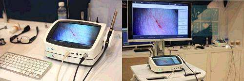 佛羅里達(dá)(Florida) 電子牙周探針